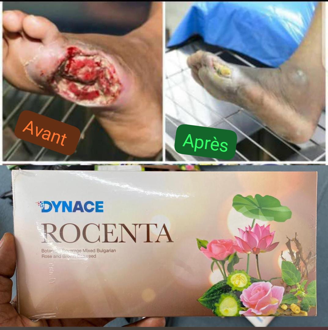 Dynace Rocenta : Votre Renaissance Cellulaire – Plus qu’un Complément, Une Seconde Chance